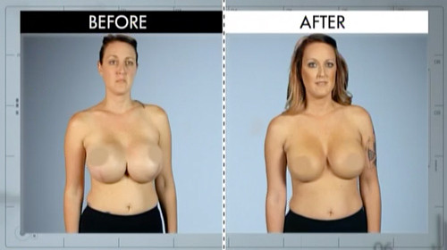 Botched Recap, EP 101 Botched Recap, EP 101